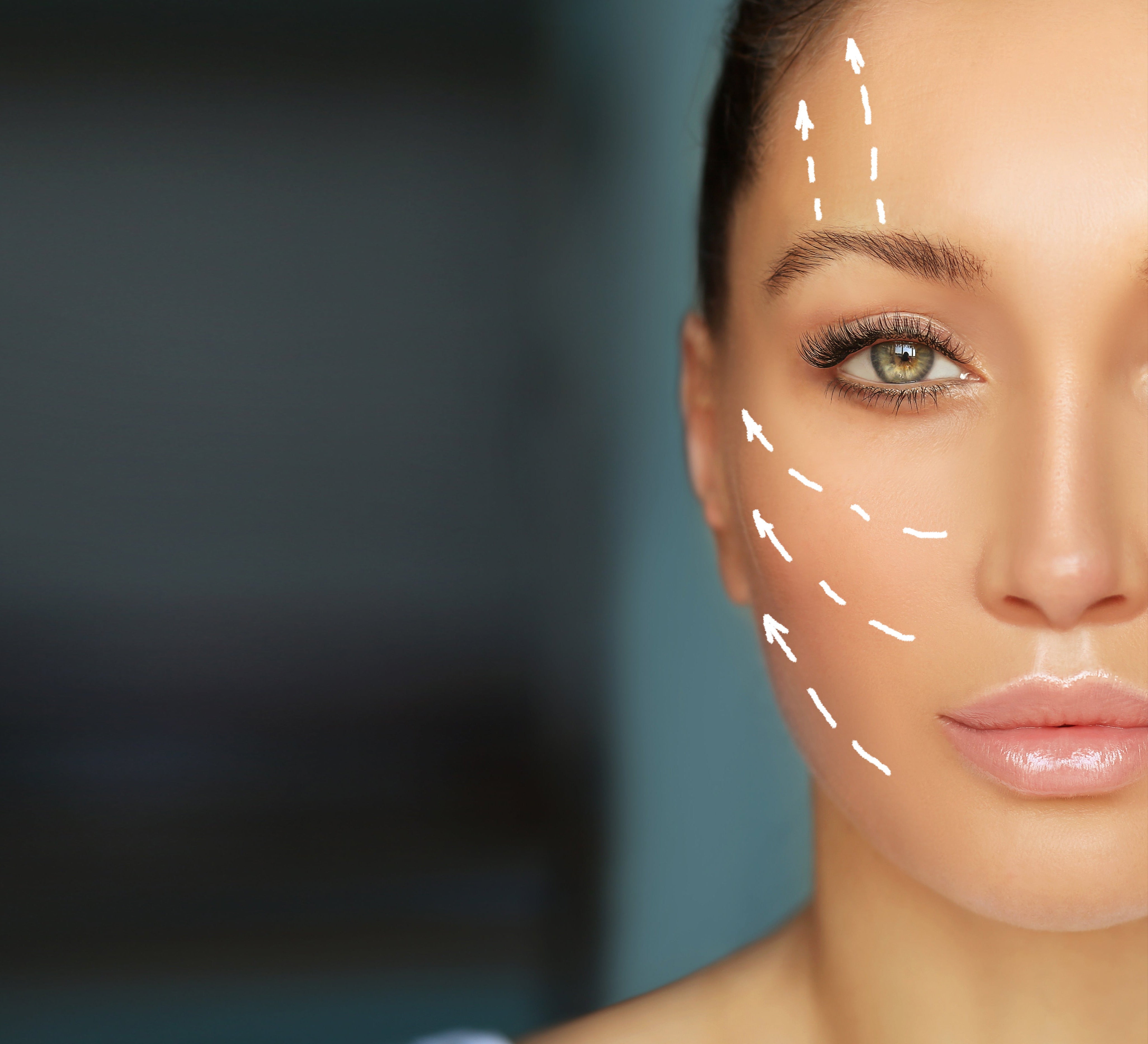 iLLUMAPen UK Microchanneling System w/ 10 pieces tips